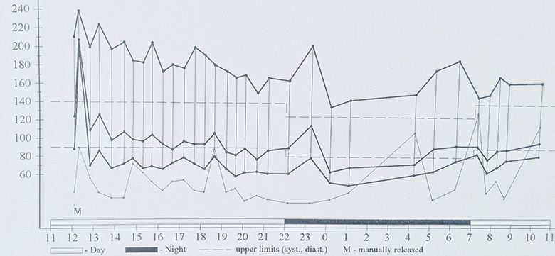 Hypertension